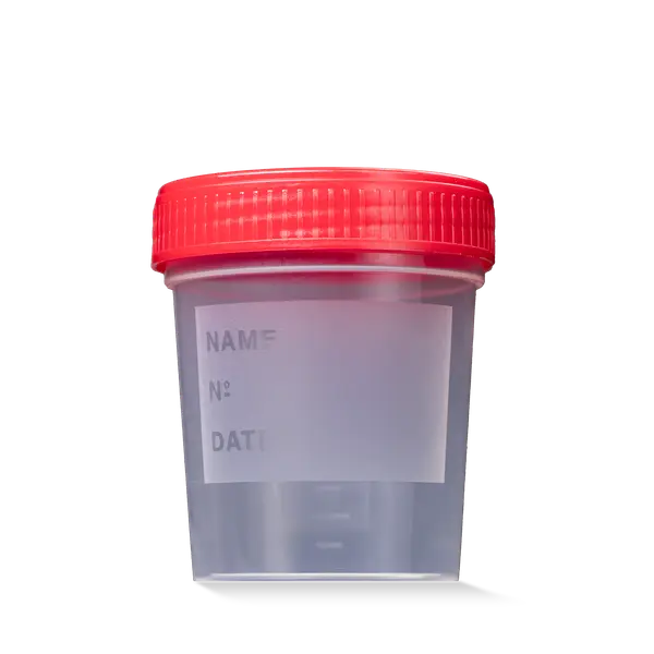 L-09184-R MC Posuda za urin 125 ml sa crvenim zatvaračem