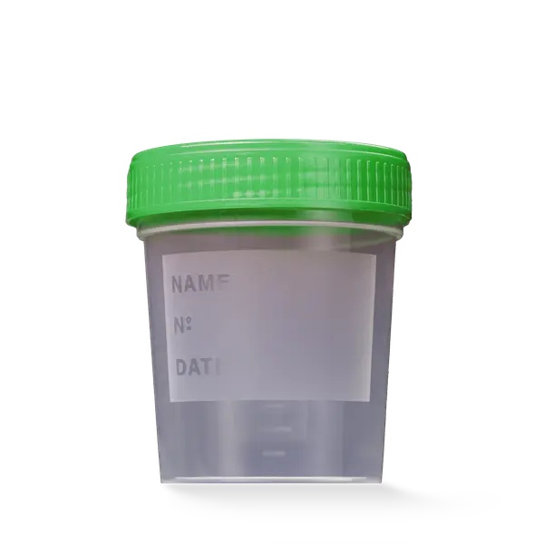 L-09184 MC Posuda za urin 100 mL sa zelenim zatvaračem